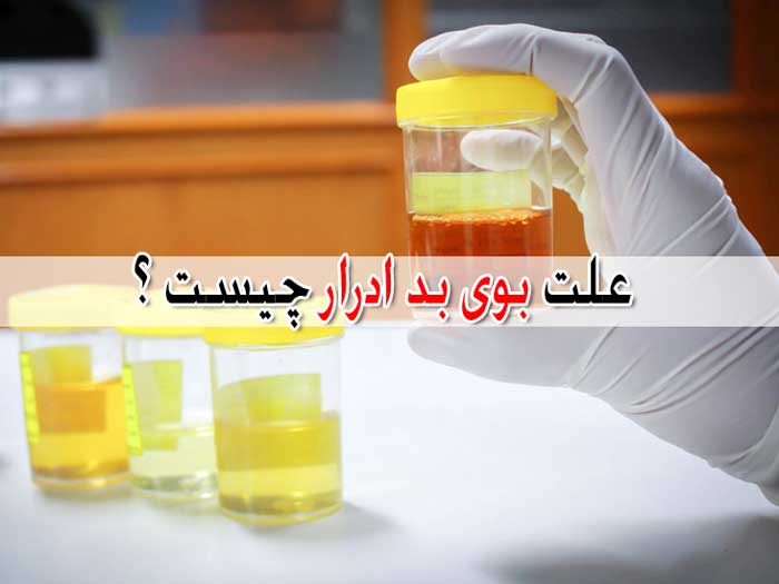 بوی بد ادرار چه علتی دارد و آیا می تواند نشانه بیماری باشد ؟