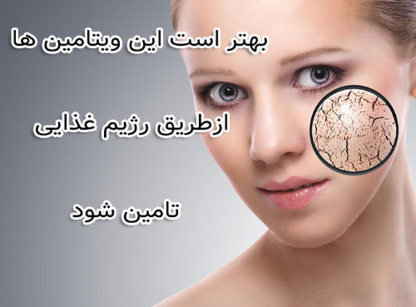 ویتامین های مفید برای درمان خشکی پوست - تغذیه سالم